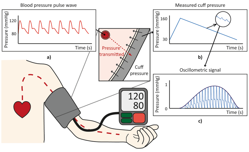 Correlation analysis of human upper arm parameters to oscillometric signal in automatic blood pressure measurement.PNG